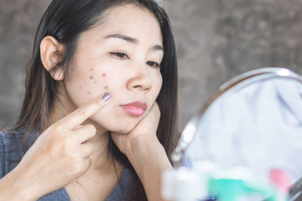dark spot corrector for face