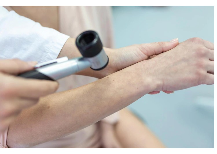 dermatologist encino