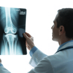 Orthopedic doctor examining knee x-ray